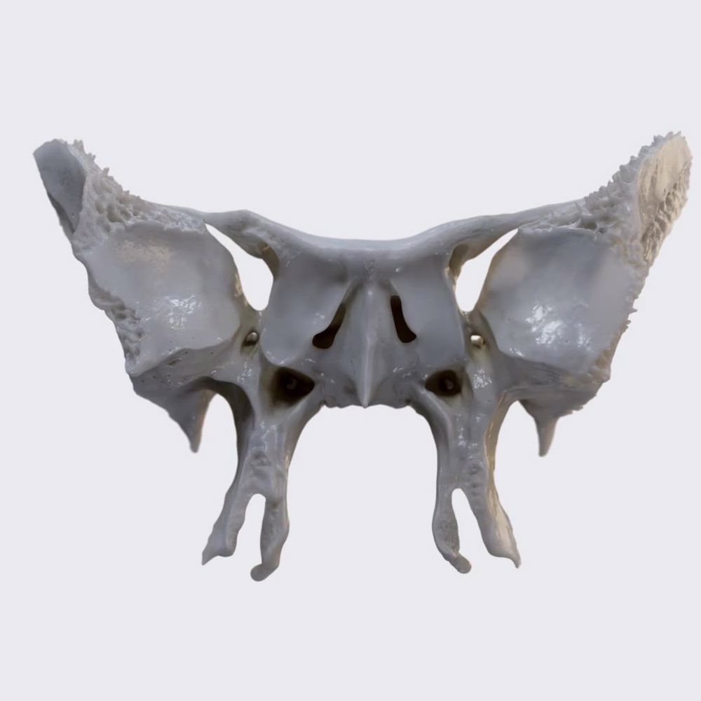 Overview of sphenoid bone